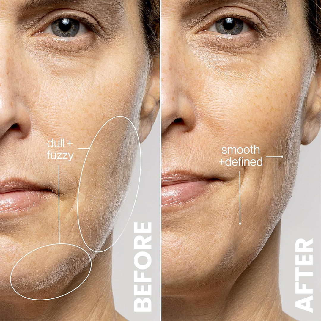 5MINSKIN ELECTRIC DERMAPLANING TOOL + FREE HAIR IDENTIFIER SPRAY - 50% OFF  BLACK FRIDAY SALE